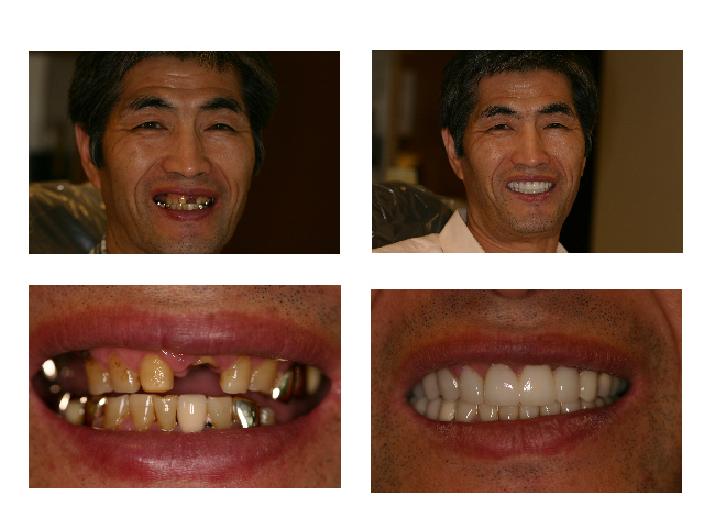 FC dental-Fairfax (Michael Song DDS, PC) | 3975 Fair Ridge Dr #301n, Fairfax, VA 22033, USA | Phone: (703) 385-5455