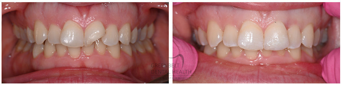 Greenbelt Dental Health | 1301 W 25th St #402, Austin, TX 78705, United States | Phone: (512) 472-3565