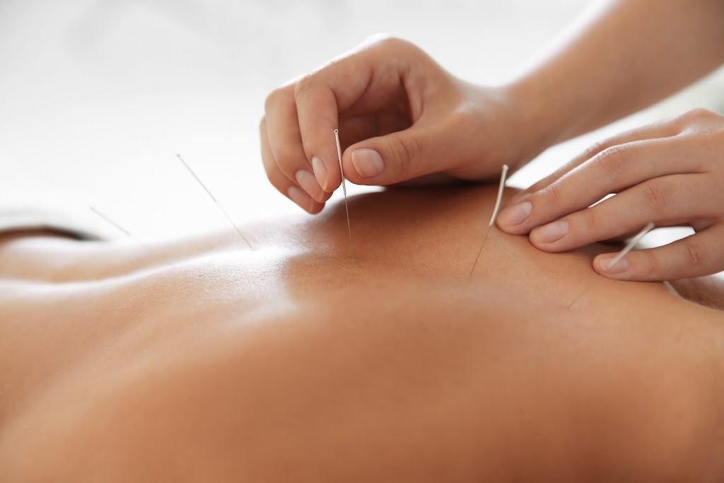 World Acupuncture | 175 Tompkins Ave Suite 200, Pleasantville, NY 10570, USA | Phone: (914) 354-3920