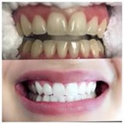 All Smiles Family Dental - Dr Sandhya Pallam DDS | 537 E Dundee Rd, Palatine, IL 60074 | Phone: (847) 907-0585