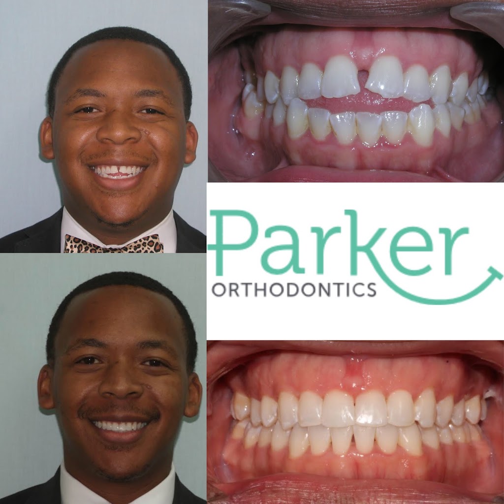 Parker Orthodontics | 200 Railroad Ave, Donaldsonville, LA 70346, USA | Phone: (225) 473-6434