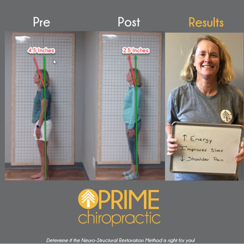 Prime Chiropractic | 5956 S Holly St, Greenwood Village, CO 80111, USA | Phone: (720) 676-6440