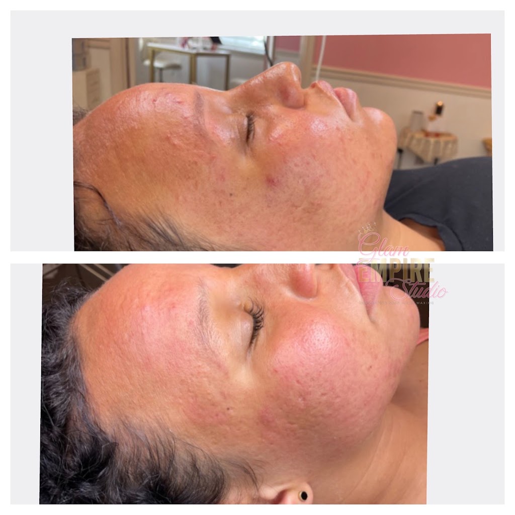 Glam Empire Studio LLC- Corrective Skin Care & Waxing | 213 Old Padonia Rd #2, Cockeysville, MD 21030, USA | Phone: (443) 826-0846