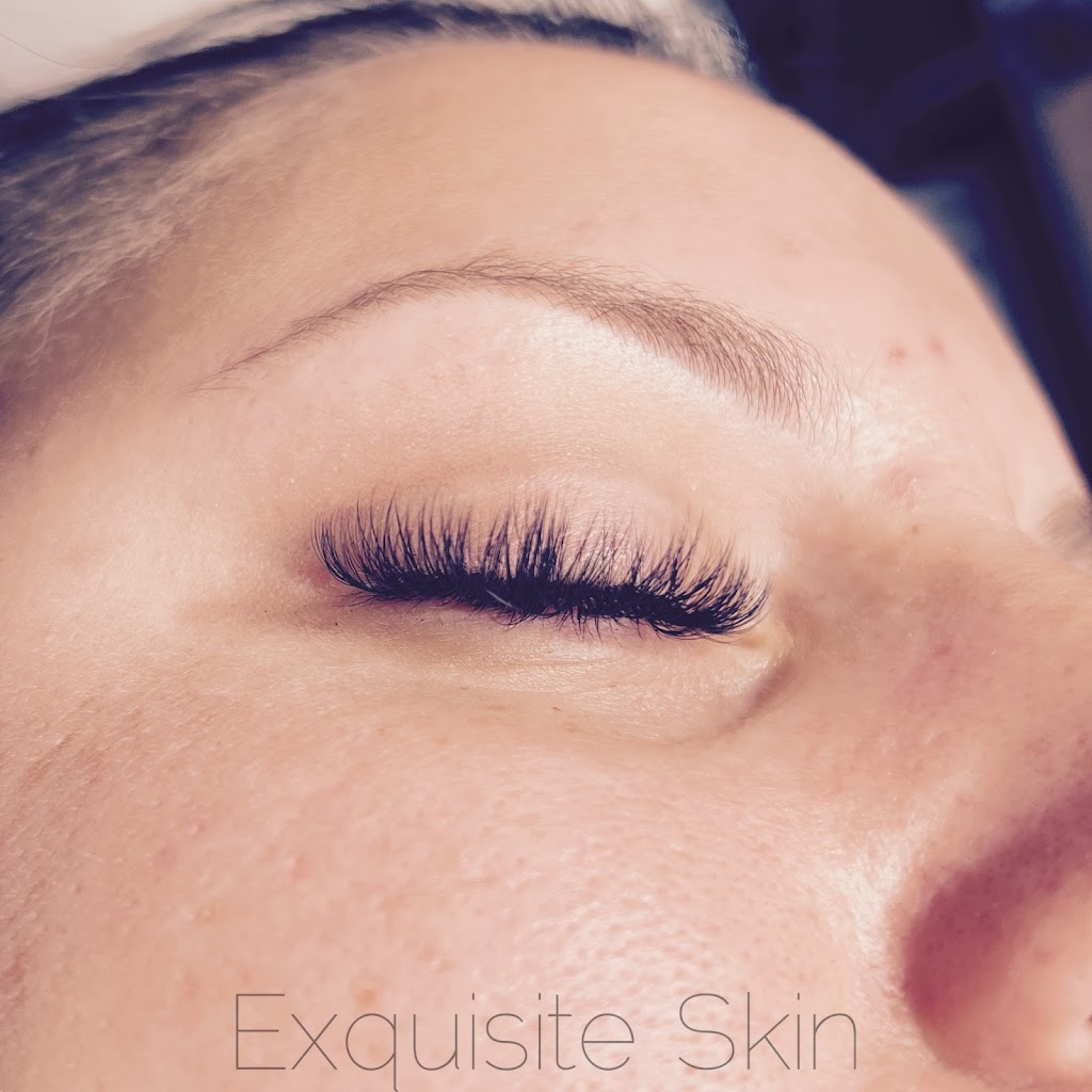 Exquisite Skin | 87011 Professional Way, Yulee, FL 32097, USA | Phone: (904) 468-3838