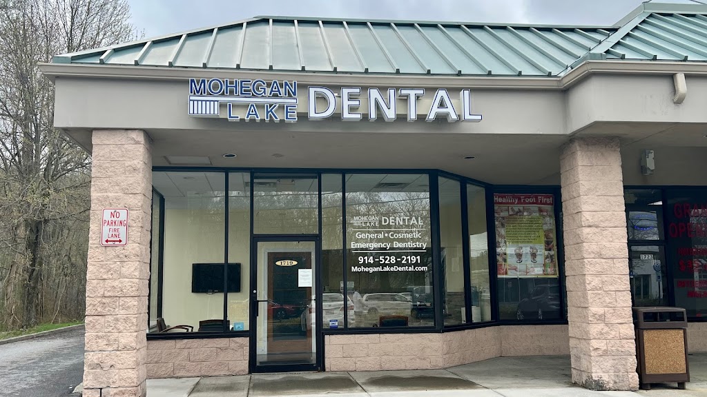 Mohegan Lake Dental PC | 1719 E Main St, Mohegan Lake, NY 10547, USA | Phone: (914) 528-2191