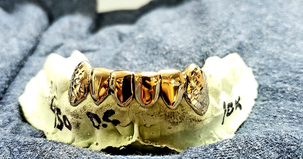 WG Gold Grillz | 10300 SW 72nd St # 280, Miami, FL 33173 | Phone: (786) 712-9299