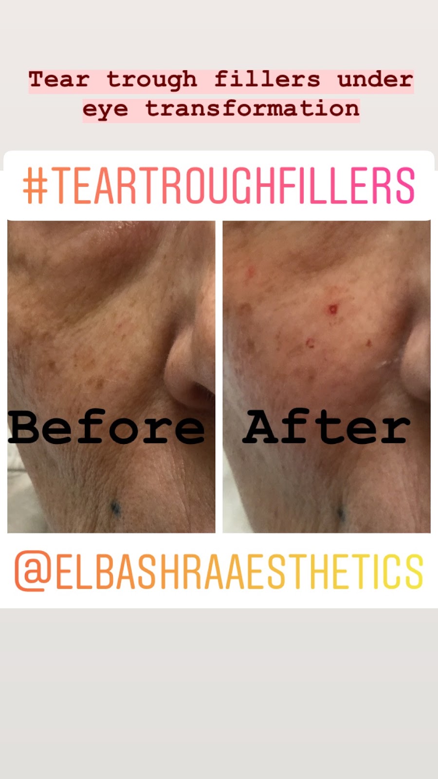 El Bashra Aesthetics | 17035 N 67th Ave suite 9, Glendale, AZ 85308, USA | Phone: (623) 498-7255