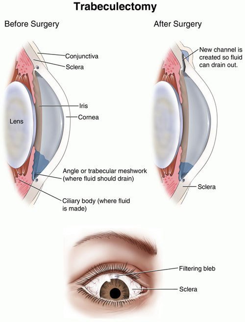 Eye One Surgical Associates | 6510 Kenilworth Ave Suite 1300, Riverdale, MD 20737, USA | Phone: (301) 699-1882