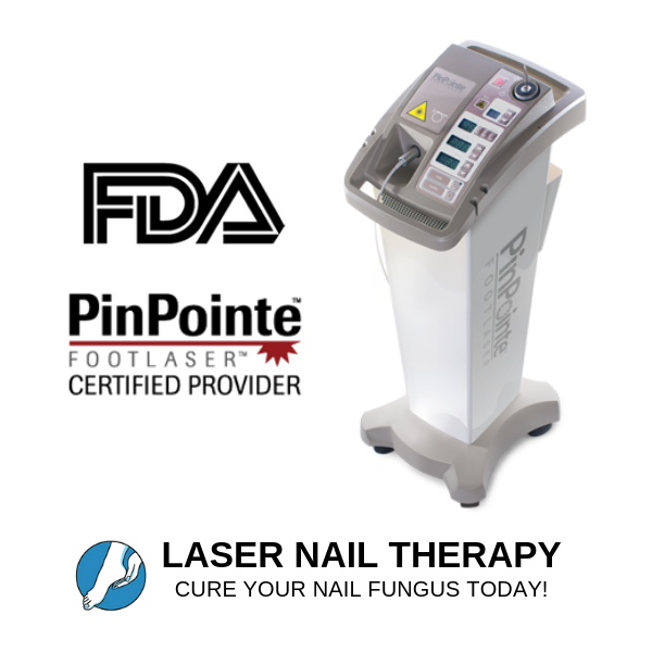 Laser Nail Therapy | 1011 Devonshire Dr F, Encinitas, CA 92024, USA | Phone: (442) 333-1826