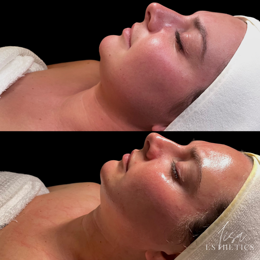 Lisa Esthetics | 5809 Bardstown Rd, Louisville, KY 40291, USA | Phone: (859) 913-9158