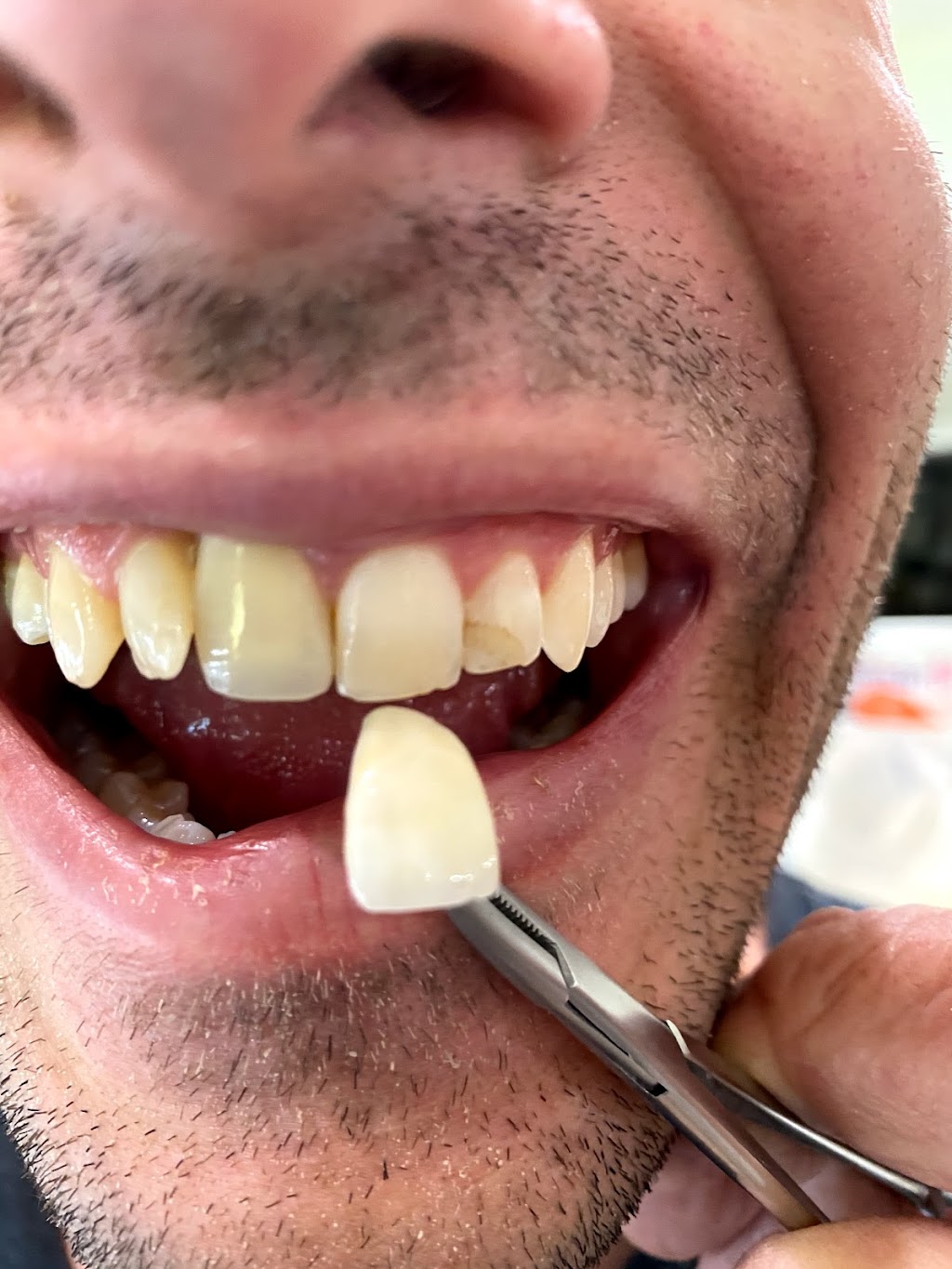 Custom Dental Arts | 2927 Salvio St, Concord, CA 94519, USA | Phone: (925) 285-9555