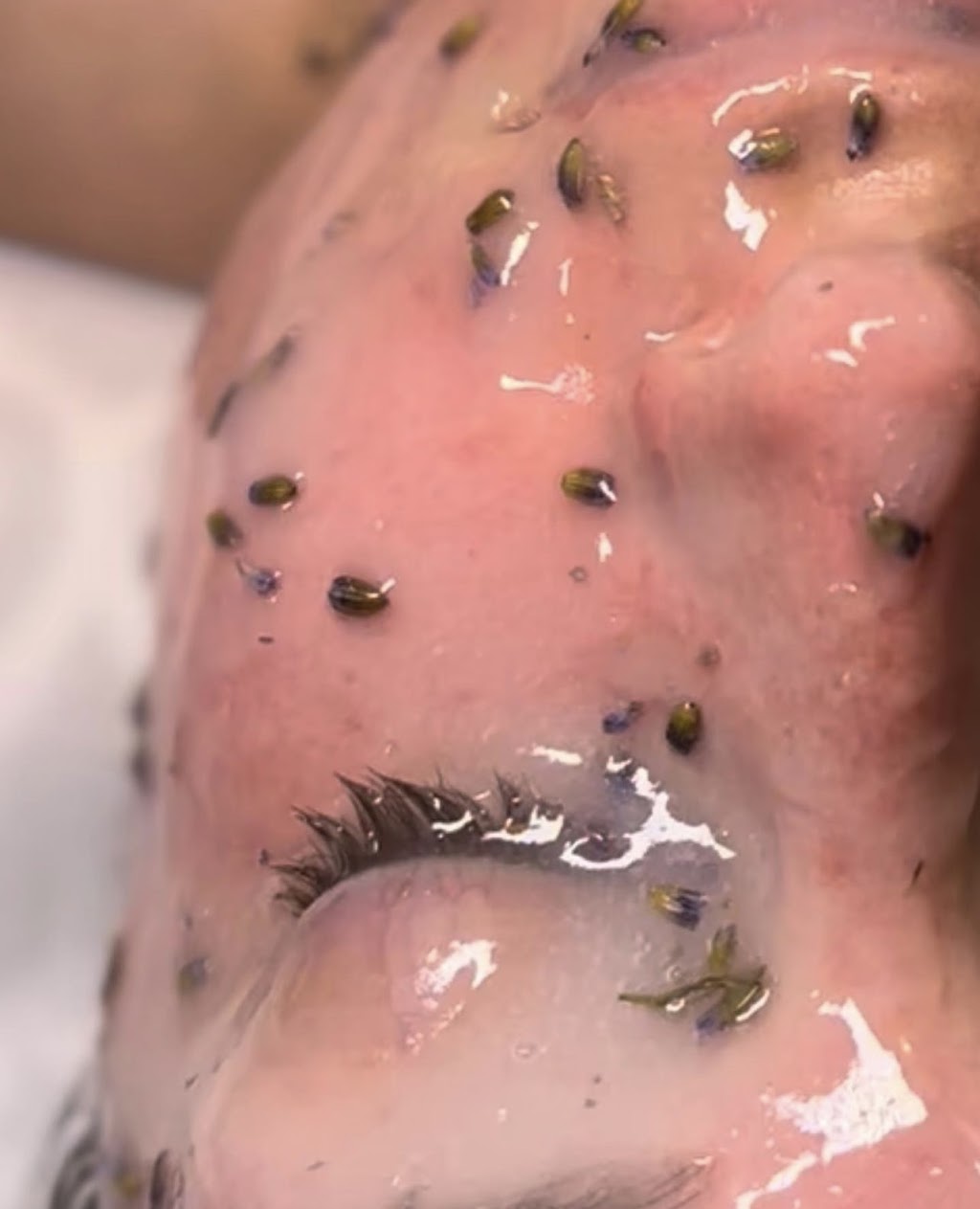 About Face Esthetics LLC | 517 E Main St, Middletown, NY 10940, USA | Phone: (845) 956-0064