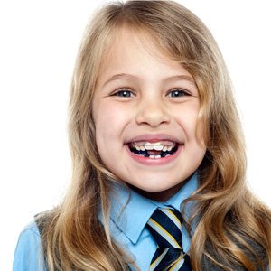 Little Diamonds Pediatric Dentistry | 3801 Fairfax Dr #42, Arlington, VA 22203, United States | Phone: (703) 988-7455