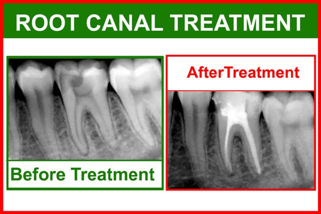 Aesthetic Family Dentistry | 2012 N 117th Ave Ste 103, Omaha, NE 68164, USA | Phone: (402) 983-9343