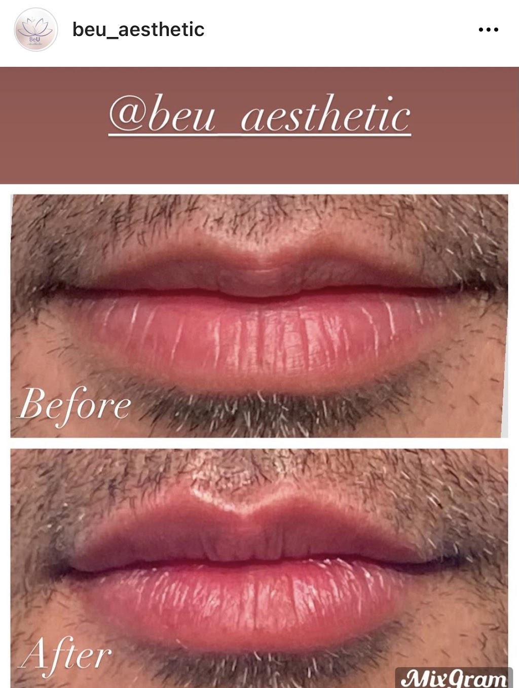 BeU Aesthetic | 10 Broadway, Valhalla, NY 10595, USA | Phone: (917) 238-8361