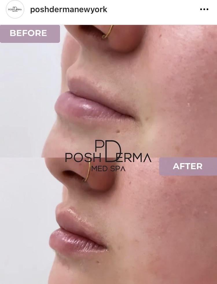 Posh Derma Med Spa | 2231 Central Park Ave, Yonkers, NY 10710, USA | Phone: (914) 639-2424