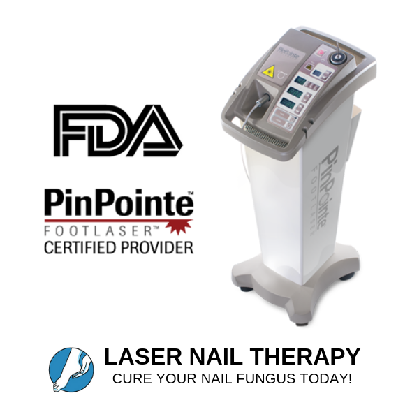 Laser Nail Therapy | 212 E Foothill Blvd, Arcadia, CA 91006, USA | Phone: (626) 495-3885