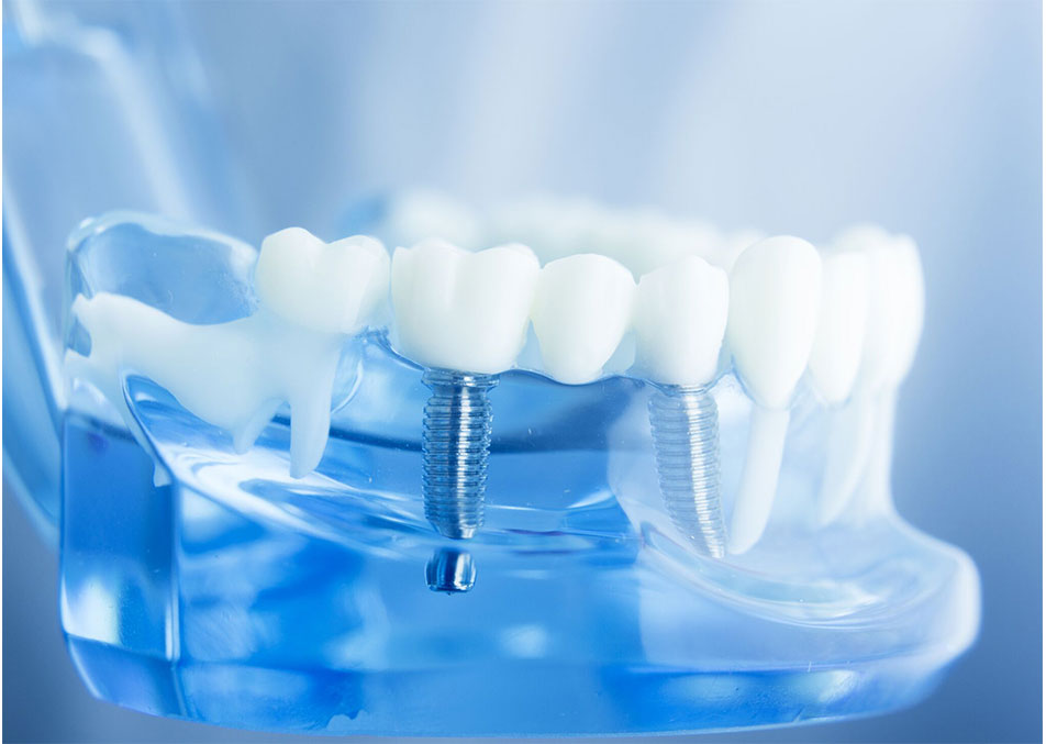 Dental Group of Lubbock | 11824 Indiana Ave Suite 200, Lubbock, TX 79423, USA | Phone: (806) 855-3942