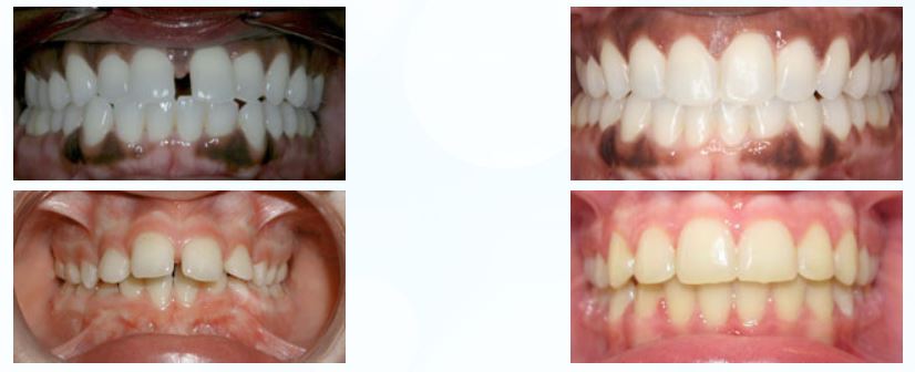 Central Texas Orthodontics - Dr. Brian St.Louis | 3413 W Slaughter Ln, Austin, TX 78748, USA | Phone: (512) 292-1910