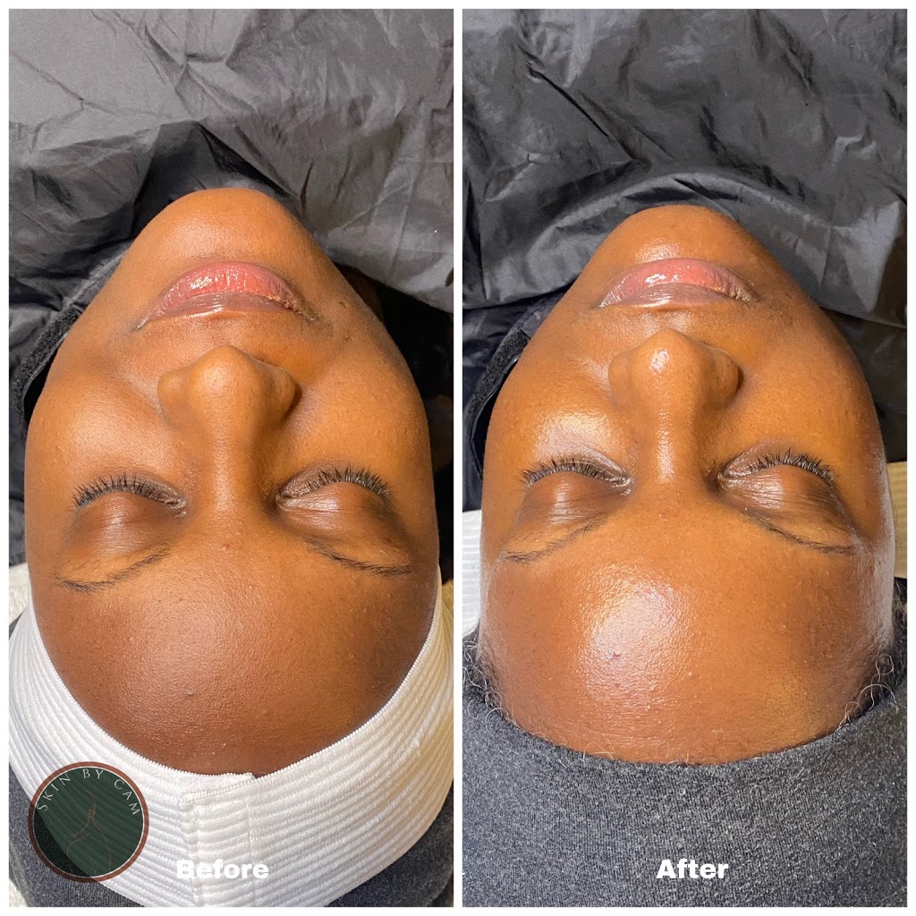 Skin By Cam, LLC | 4600 Powder Mill Rd Suite 450-S32, Beltsville, MD 20705, USA | Phone: (443) 765-1064