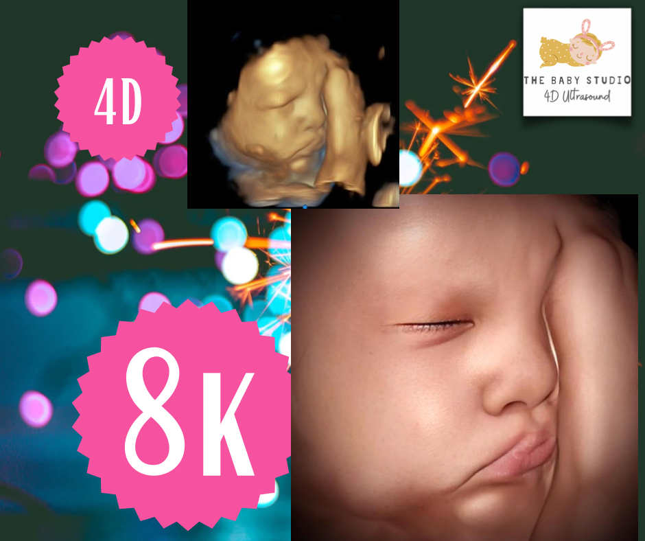 The Baby Studio 4D Ultrasound | 111 N 5th St, Chickasha, OK 73018 | Phone: (405) 759-4051