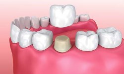 Cambridge Dental Group | 1608 NJ-88 Suite 205, Brick Township, NJ 08724, United States | Phone: (732) 482-9982