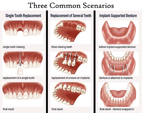 Best Choice Dentures | 565 Colonial Park Dr, Roswell, GA 30076, USA | Phone: (770) 642-0500