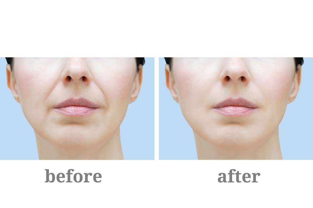 Botox St. Louis | 2510 S Brentwood Blvd #202 A, St. Louis, MO 63144, USA | Phone: (314) 942-7514