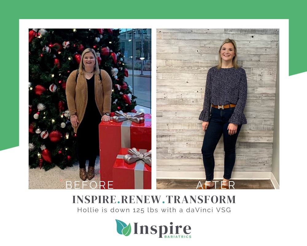 Inspire Bariatrics | 5561 Virginia Pkwy Suite 300, McKinney, TX 75071 | Phone: (469) 634-1004