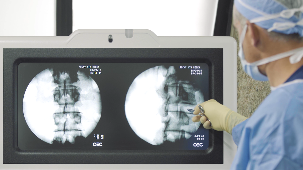 Rocky Mountain Regenerative Medicine | 720 Pearl St STE 1B, Boulder, CO 80302, USA | Phone: (720) 739-1616