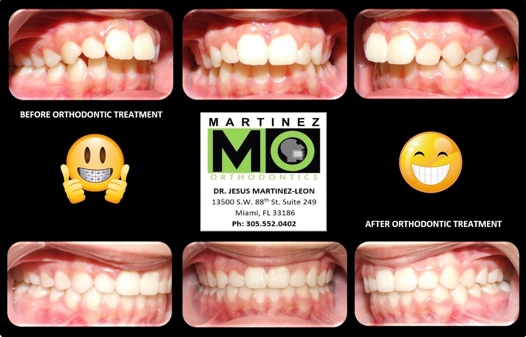Martinez Orthodontics: Braces & Clear Aligners | 13500 SW 88th St STE 249, Miami, FL 33186, USA | Phone: (305) 552-0402