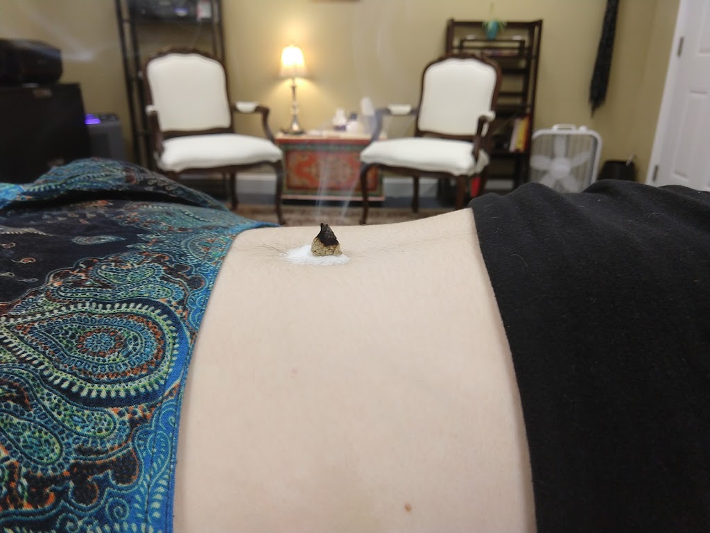 Vital Traditions Acupuncture | 4912 Berwyn Rd, College Park, MD 20740, USA | Phone: (330) 606-6376