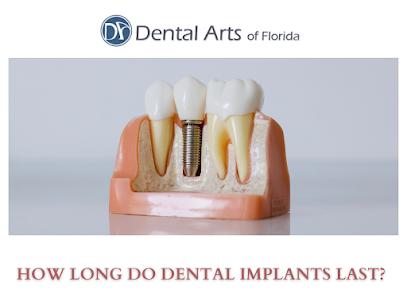 Dental Arts of Florida: Dr Fred Tepedino, DMD | 7645 Gate Pkwy #103, Jacksonville, FL 32256, United States | Phone: (904) 822-9786