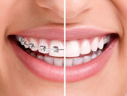 Noorani Orthodontics | 8114 Sandpiper Cir #207, Nottingham, MD 21236, USA | Phone: (410) 931-3350