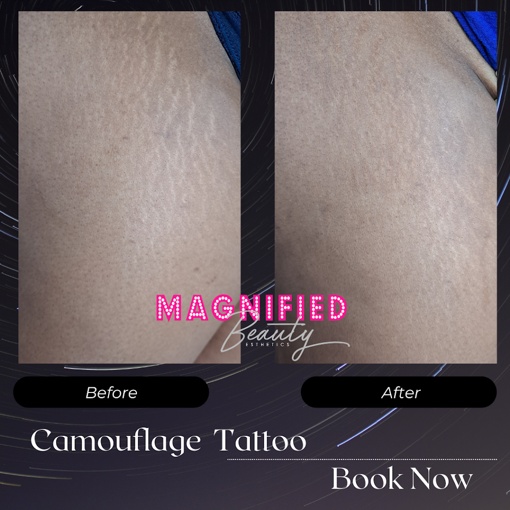 Magnified Beauty Esthetics | 31201 Chicago Rd S Ste. A103, Warren, MI 48093, USA | Phone: (586) 960-5808