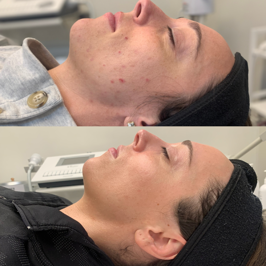 Skintuition | 220 Mt Mercy Dr, Pewee Valley, KY 40056 | Phone: (502) 309-5050