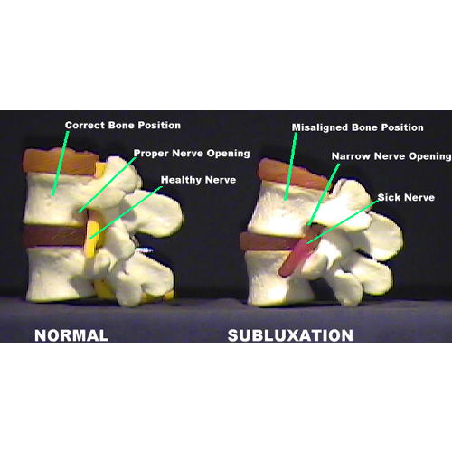 Dr. Charles Kurowski BS, DC: A Family Chiropractic Center | 121 Hampton Hwy #1, Yorktown, VA 23693, USA | Phone: (757) 867-7787