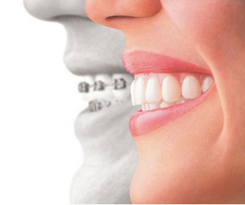 Saddlebrook Dental & Orthodontics | 905 Summitt Ave, 120 US-82, Gainesville, TX 76240, USA | Phone: (940) 580-2856