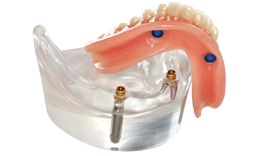 1st Class Dentures LLC | 6023 N Eagle Rd Suite 150, Boise, ID 83713 | Phone: (208) 336-8873