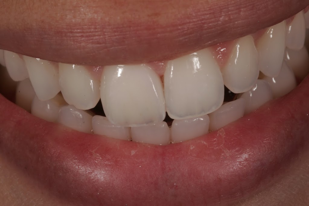 Ianto Dental Studio - health  | Photo 4 of 6 | Address: 7500 NW 5th St #101, Plantation, FL 33317, USA | Phone: (954) 792-3444
