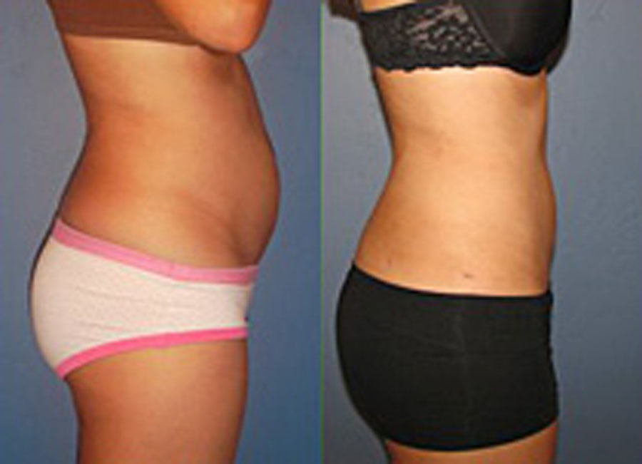 Glenn Herrmann MD | 130 Old Laramie Trail E, Lafayette, CO 80026, USA | Phone: (303) 664-9400