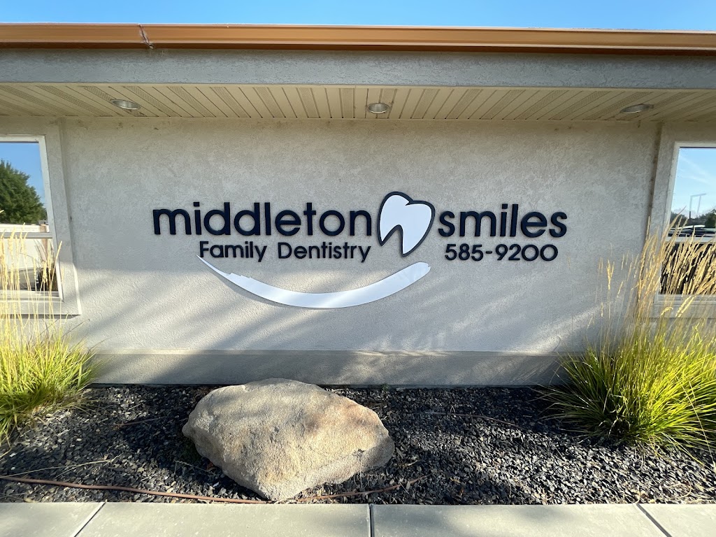 Middleton Smiles | 1064 W Main St, Middleton, ID 83644, USA | Phone: (208) 585-9200