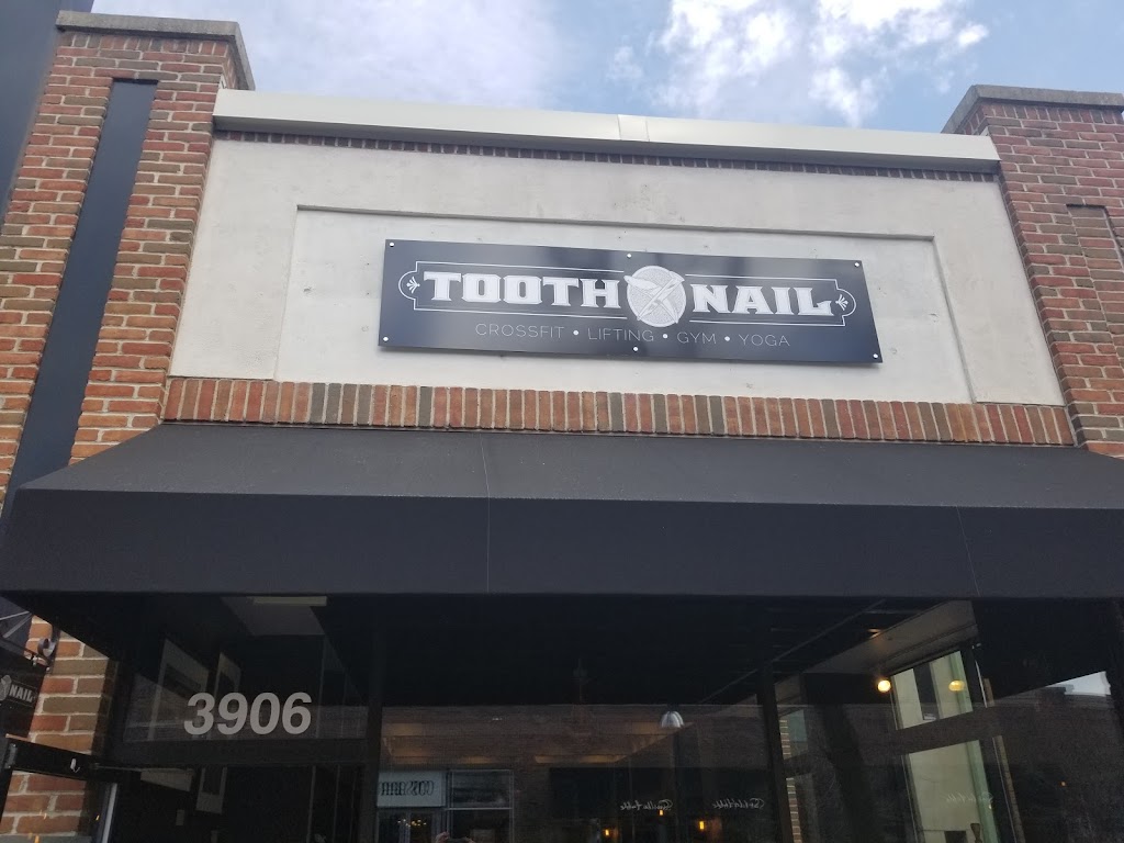 Tooth X Nail | 10 Southdale Center, Edina, MN 55435, USA | Phone: (952) 920-9726