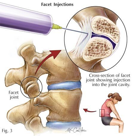 West Valley Pain Solutions | 9140 W Thomas Rd b106, Phoenix, AZ 85037, USA | Phone: (623) 939-1375