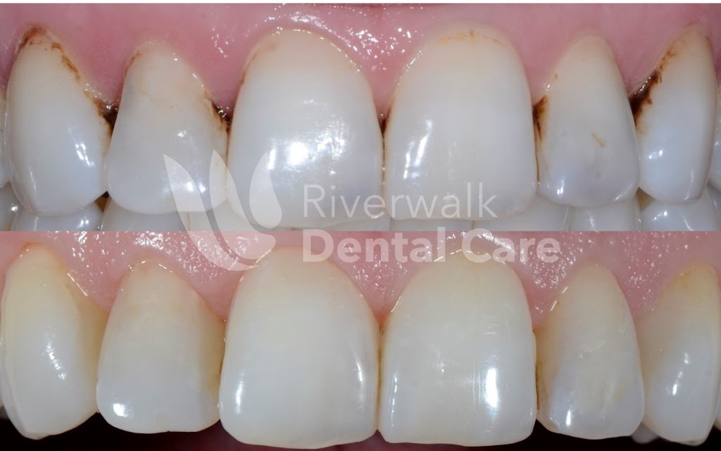 Riverwalk Dental Care | 351 Main Ave, Norwalk, CT 06851, USA | Phone: (203) 286-8668