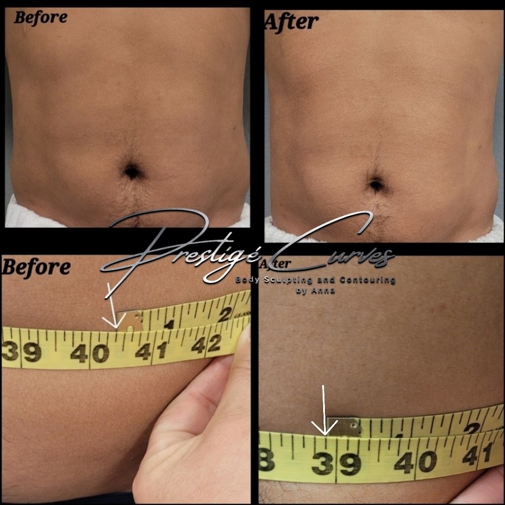 Prestigé Curves Body Sculpting | 520 W Lacey Blvd #3, Hanford, CA 93230, USA | Phone: (559) 904-9943