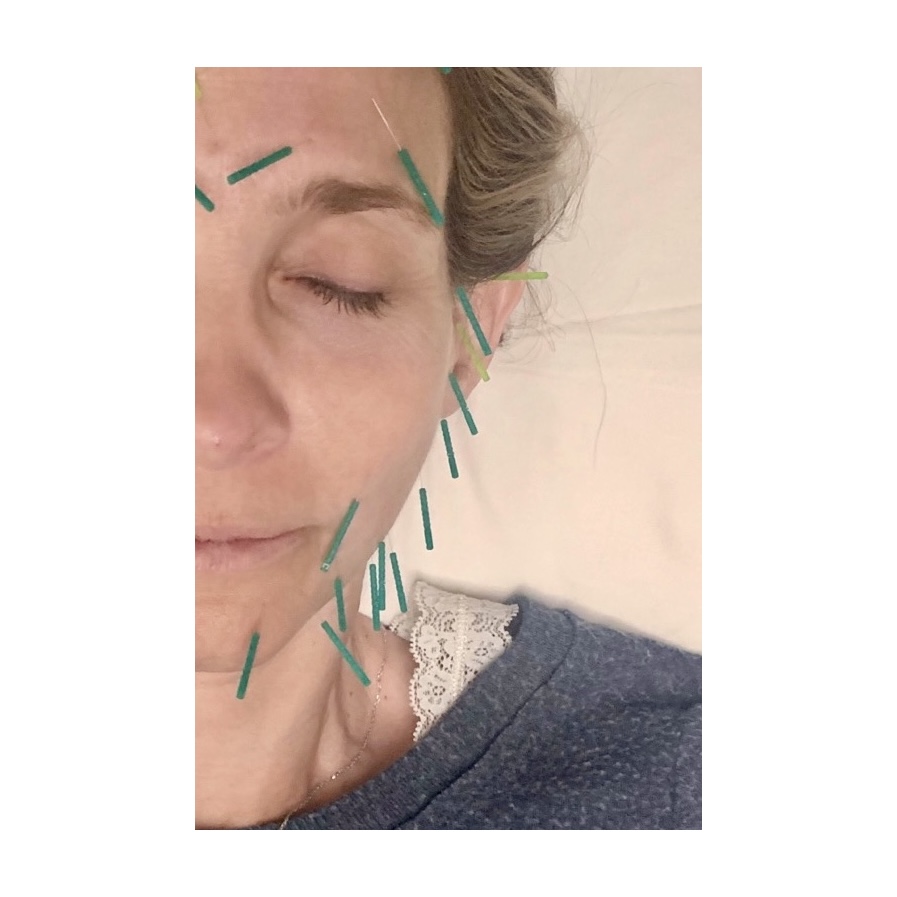 Be Real Wellness Acupuncture-Dallas | 10670 N Central Expy Suite 110, Dallas, TX 75231, USA | Phone: (512) 633-8222