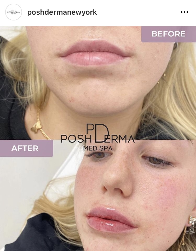 Posh Derma Med Spa | 2231 Central Park Ave, Yonkers, NY 10710, USA | Phone: (914) 639-2424