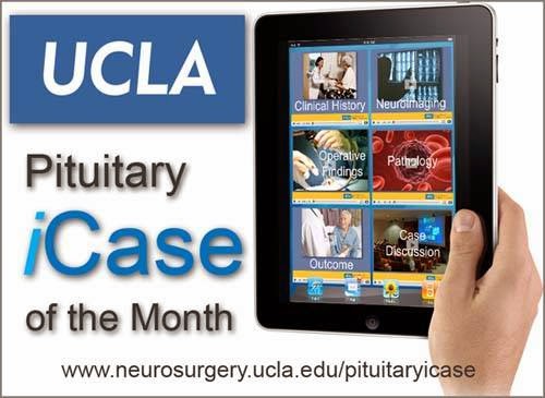 UCLA Health Westwood Neurosurgery | 300 Stein Plaza suite 420, Los Angeles, CA 90095, USA | Phone: (310) 825-5111