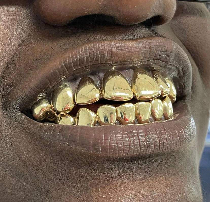 Gold Grillz & Jewelry, Gold2Ink LLC | 1503 NW 47th Ave, Lauderhill, FL 33313, USA | Phone: (979) 291-8055